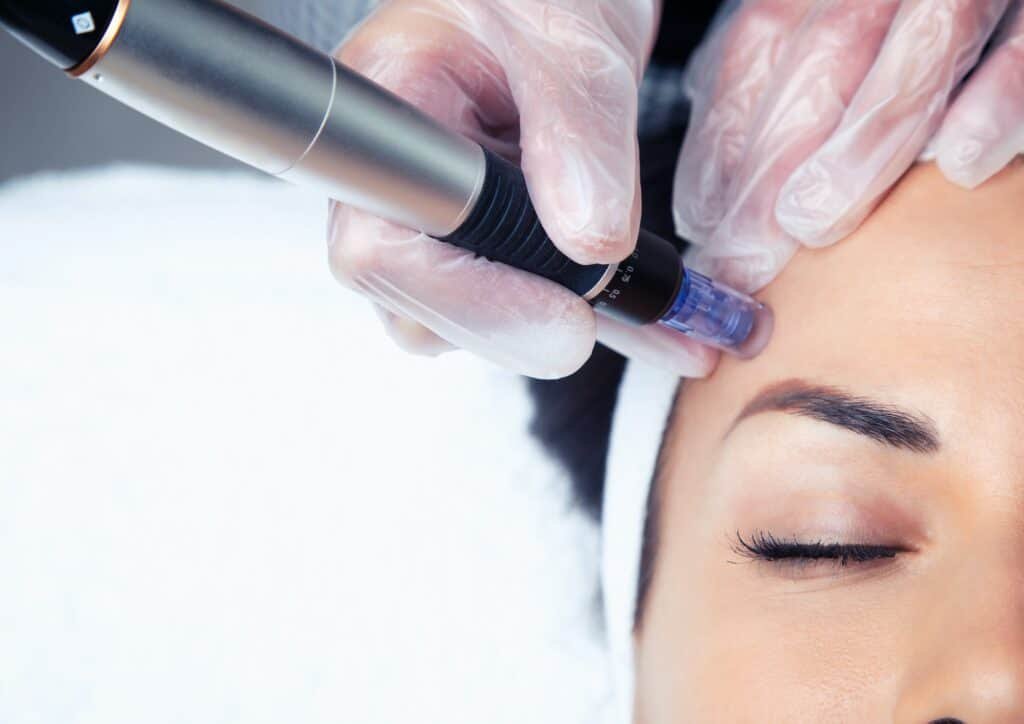 Cosmetologist making mesotherapy injection with dermapen on face for rejuvenation on the spa center.