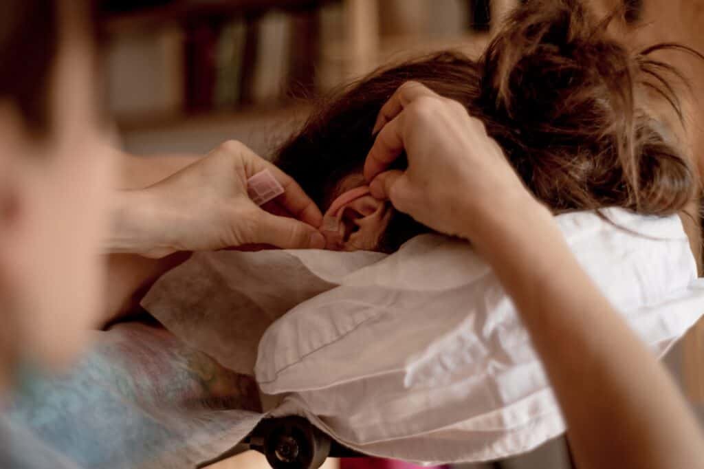 Physiotherapist is doing acupuncture on ear of a female patient, traditional chinese medicine.