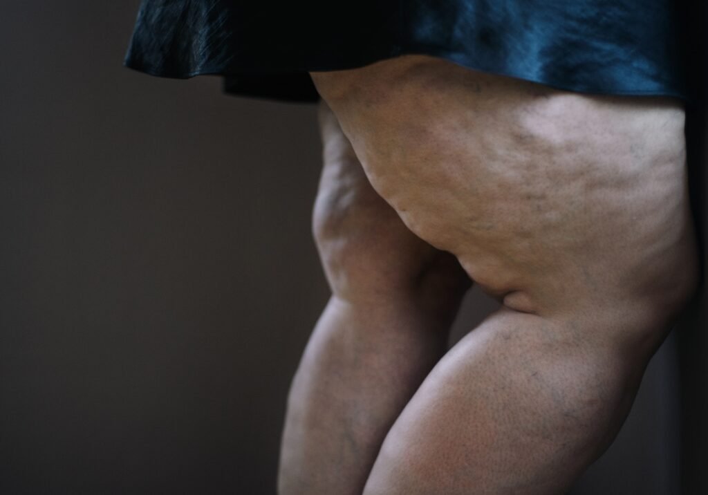 Fat woman with cellulite on her legs, cut out