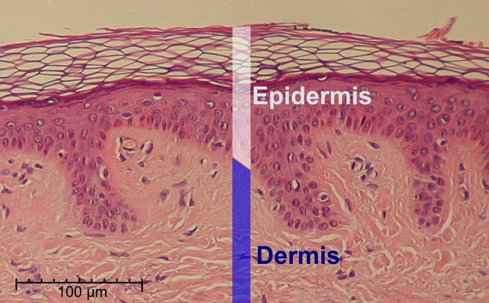 Et bilde som illustrerer dermis og epidermis