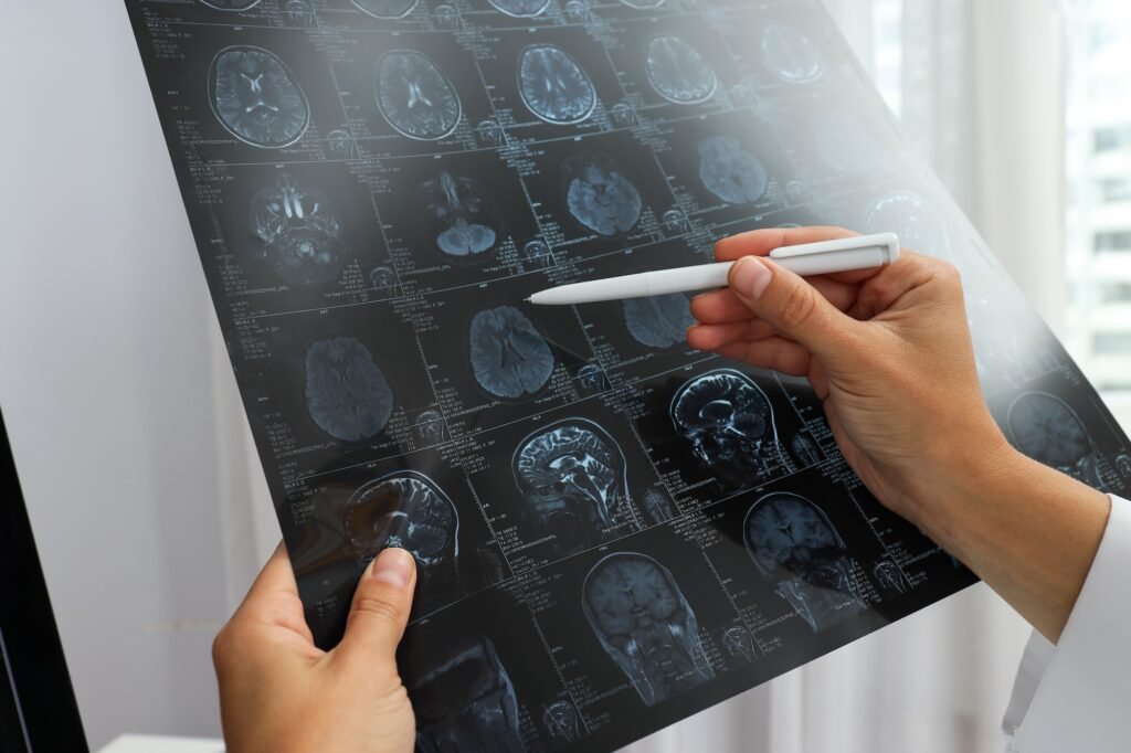 MRI images of a human head in the hands of a doctor