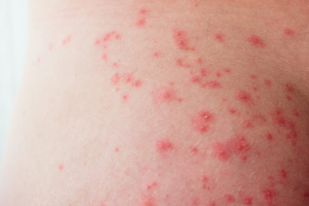 red spots on the skin close up