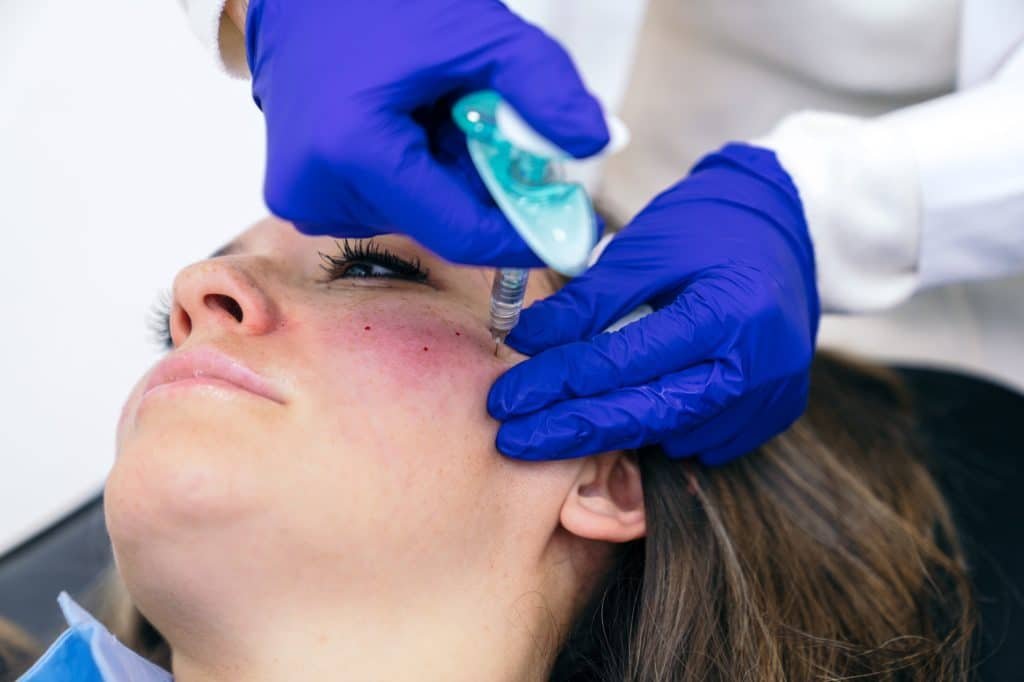 Aesthetician Injects Hyaluronic Acid for Chin Enhancement Procedure